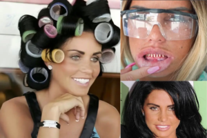 katie-price-teeth