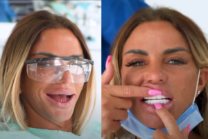 katie-price-teeth-veneer-before-after-01