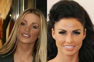 katie-price-teeth-before-after-03