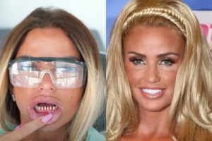 katie-price-teeth-before-after