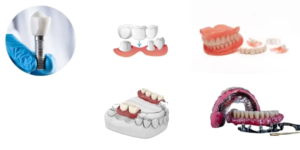 alternatif-to-dental-implants-vivimedi