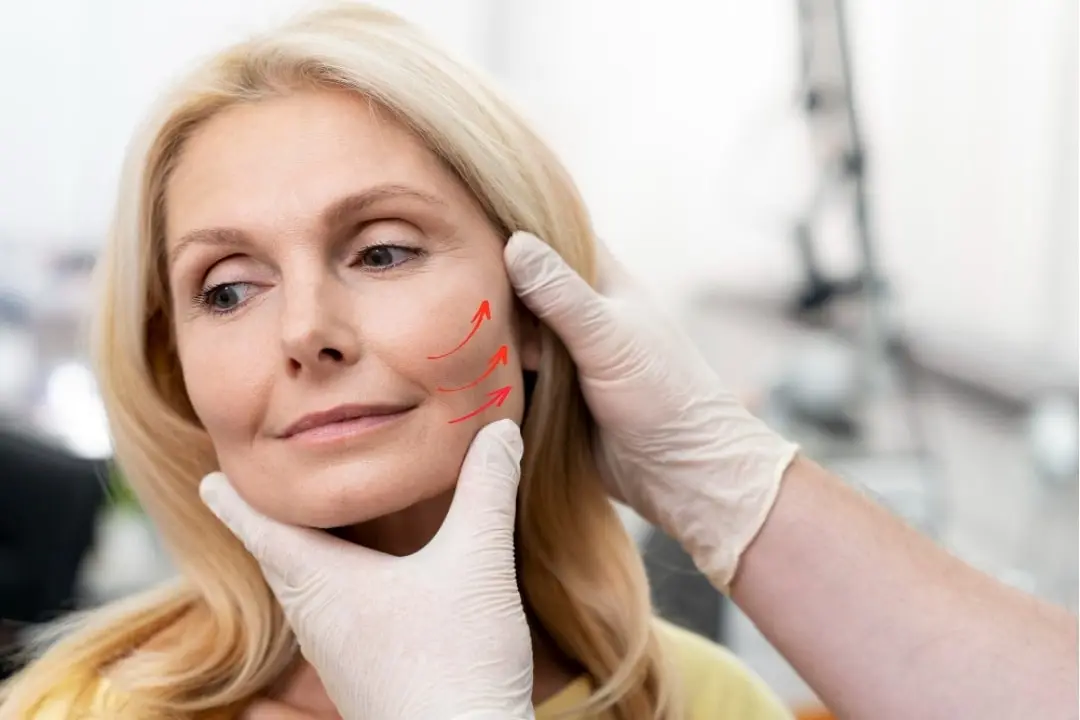 deep-plane-facelift-vivimedi