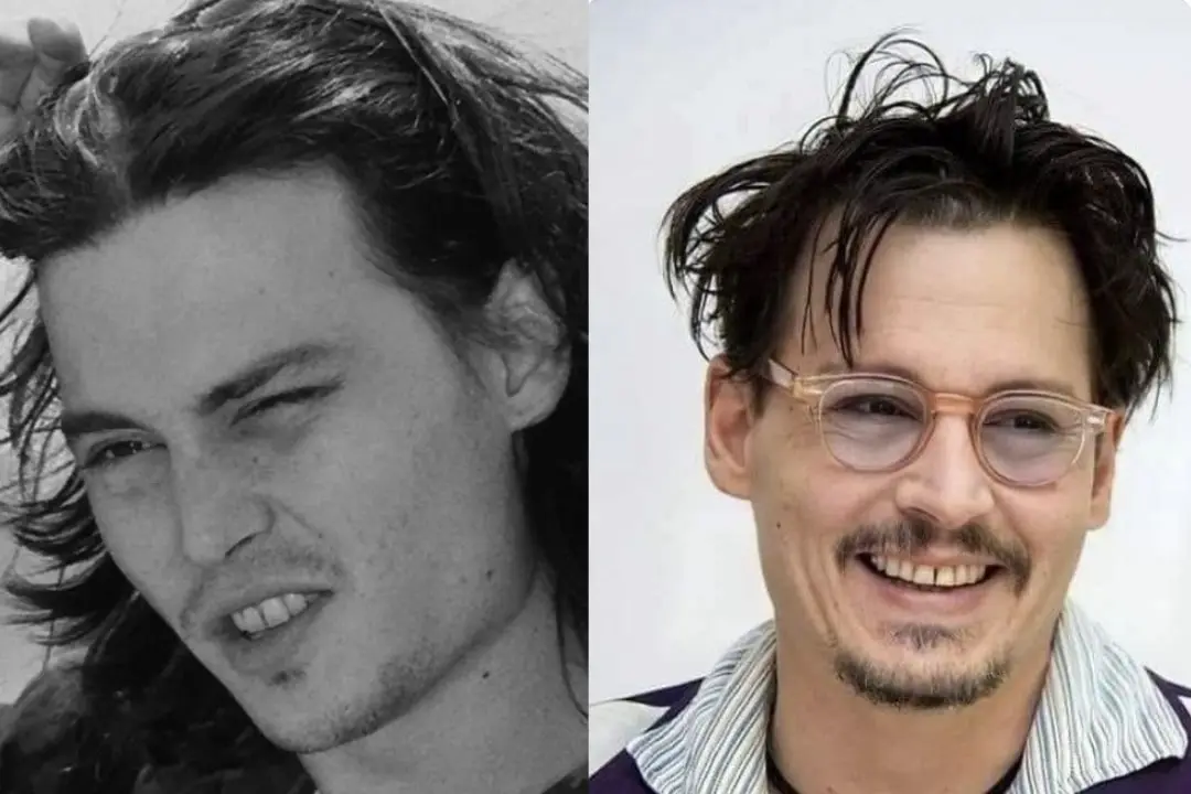 johnny-depp-teeth-before-after-01