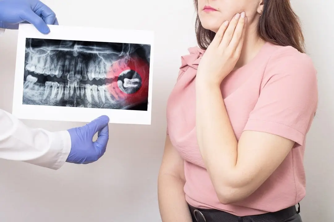 wisdom-teeth-pain