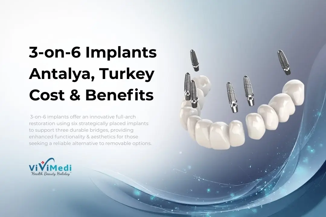 3-on-6-dental-implants Antalya Turkey