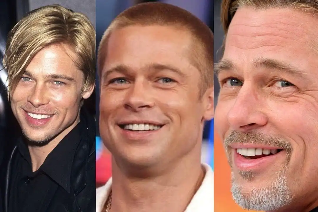Brad Pitt teeth before after