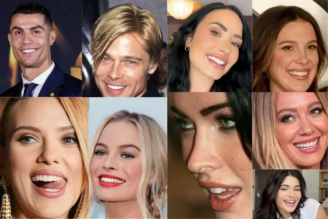 Celebrity veneers before and after