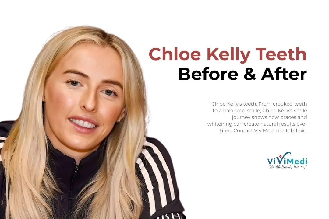 Chloe Kelly teeth before after