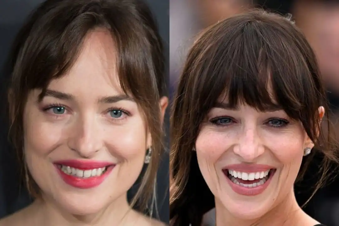 Dakota Johnson teeth before after