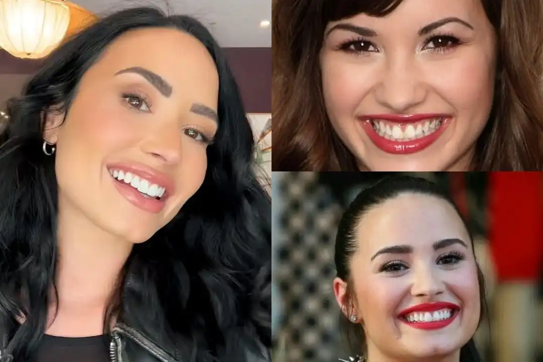 Demi Lovato teeth