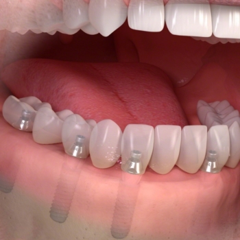 blog-image