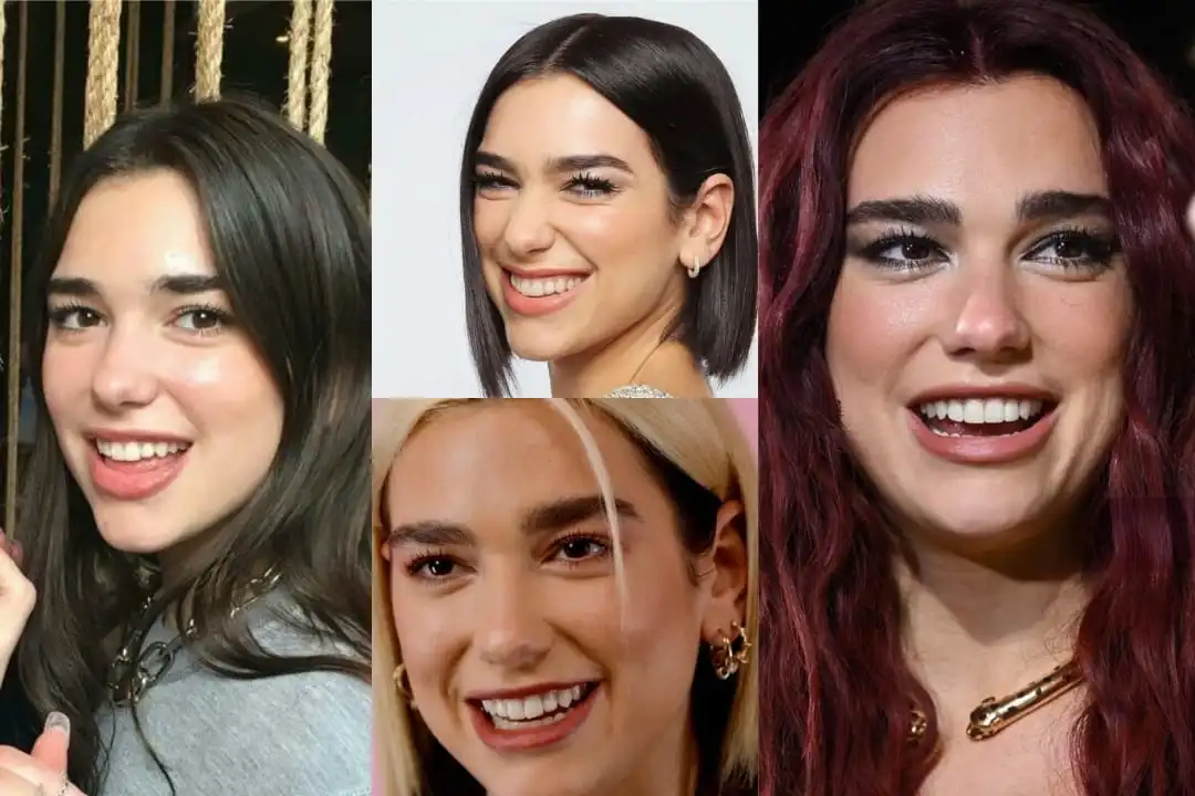 Dua Lipa teeth before after