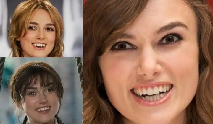 Keira Knightley teeth