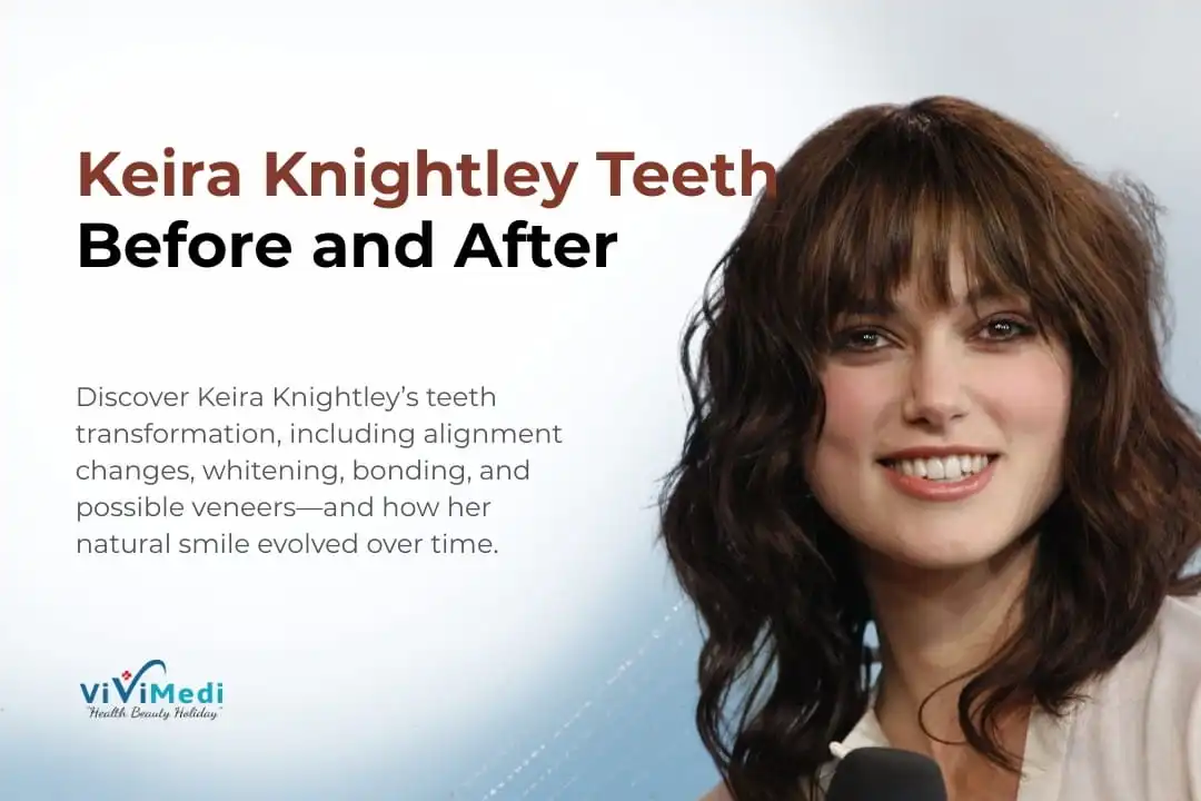 Keira Knightley teeth before and after