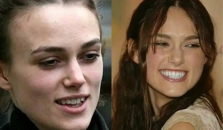Keira Knightley's smile