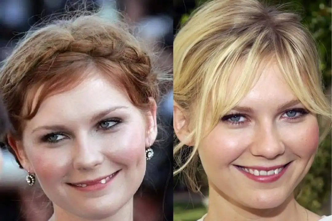 Kirsten Dunst teeth before after