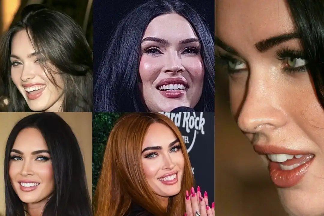 Megan Fox teeth