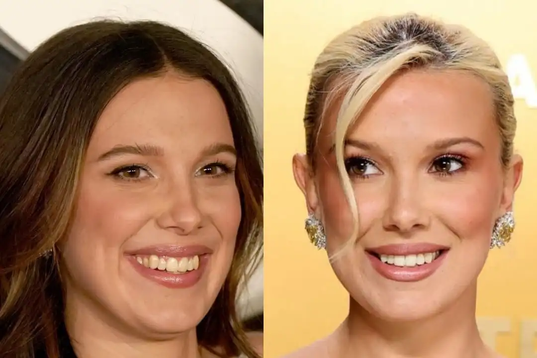Millie Bobby Brown teeth