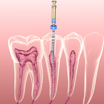 blog-image
