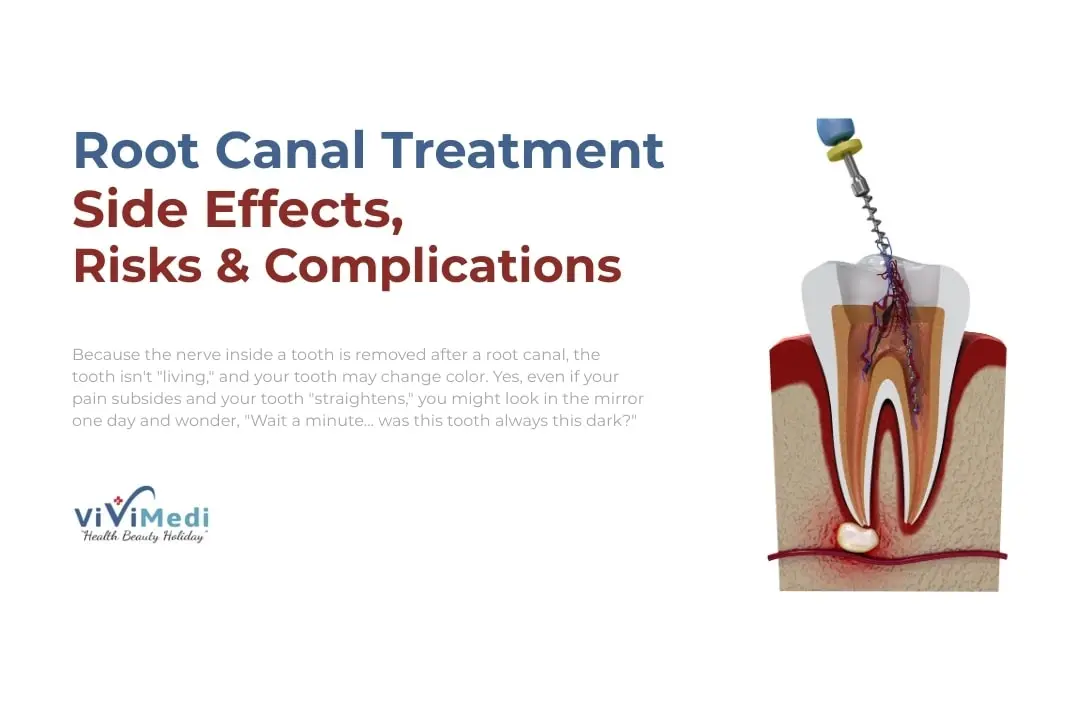 Root canal treatment side effects