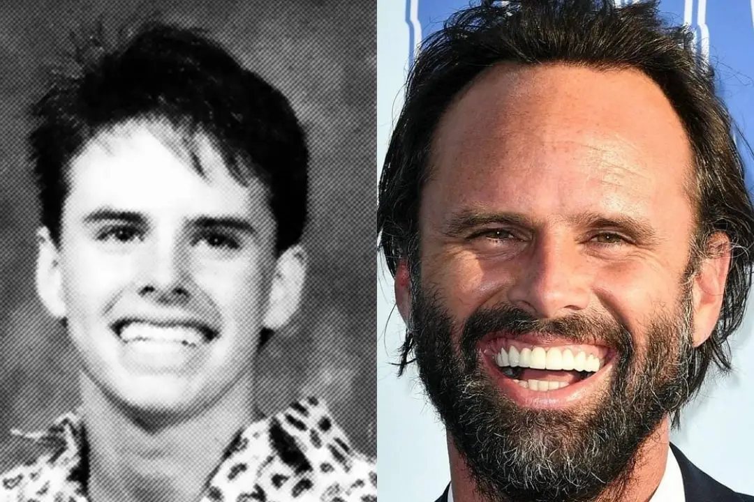 What happened to Walton Goggins' teeth?