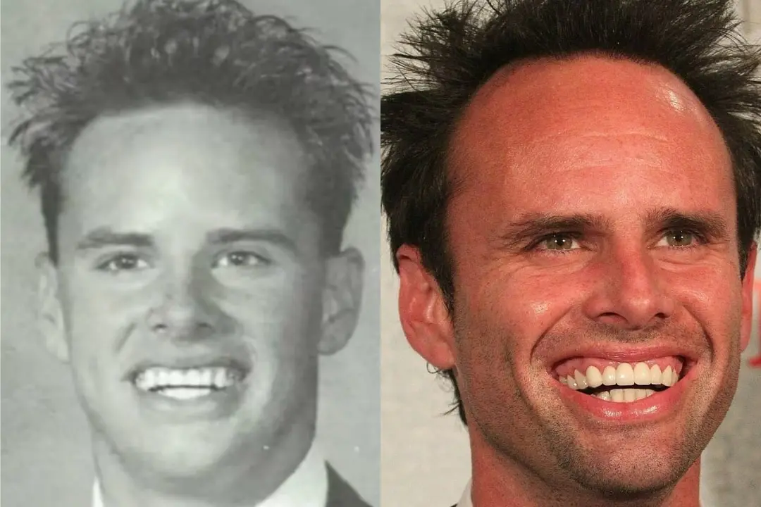 Walton Goggins teeth before and after