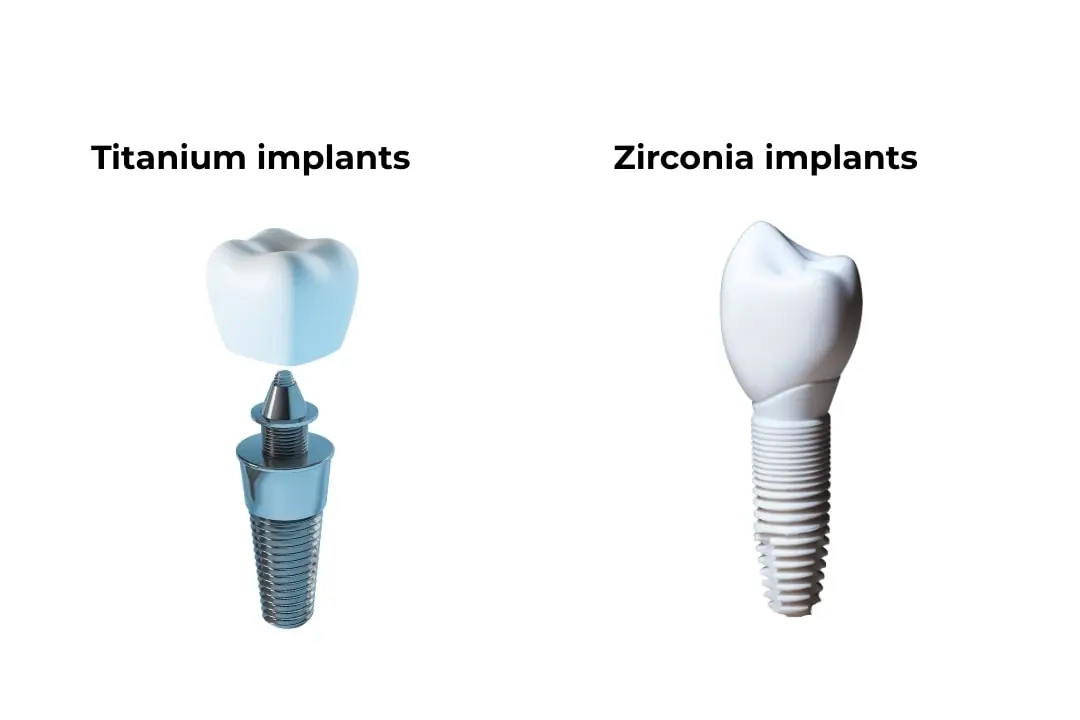 Advantages of zirconia implants over traditional implants