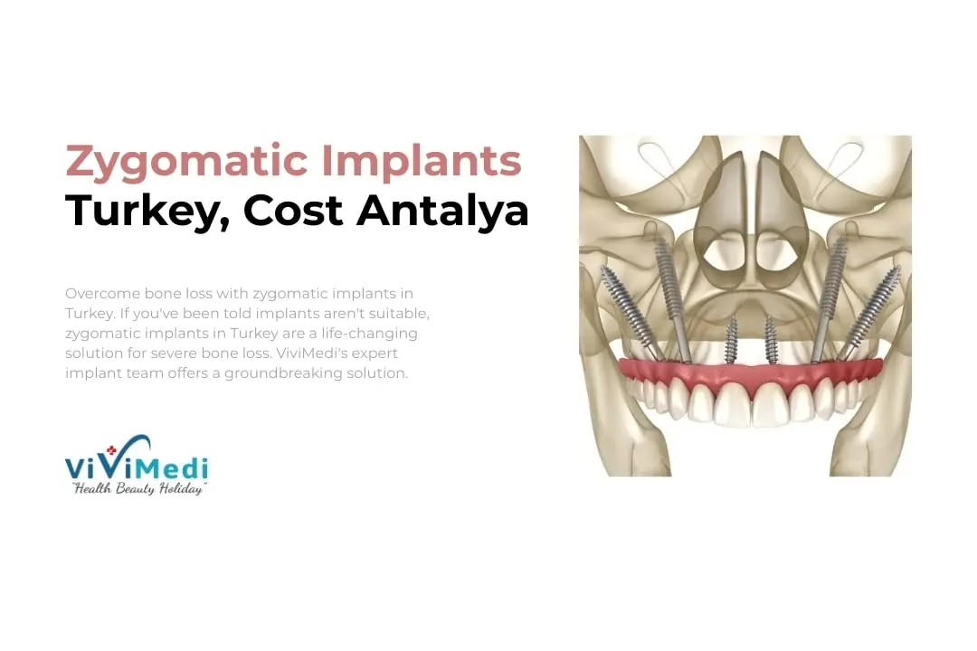 Zygomatic Implants Turkey, Cost in Antalya