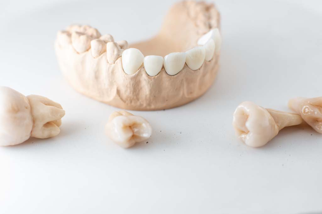 Bone Augmentation/Grafting