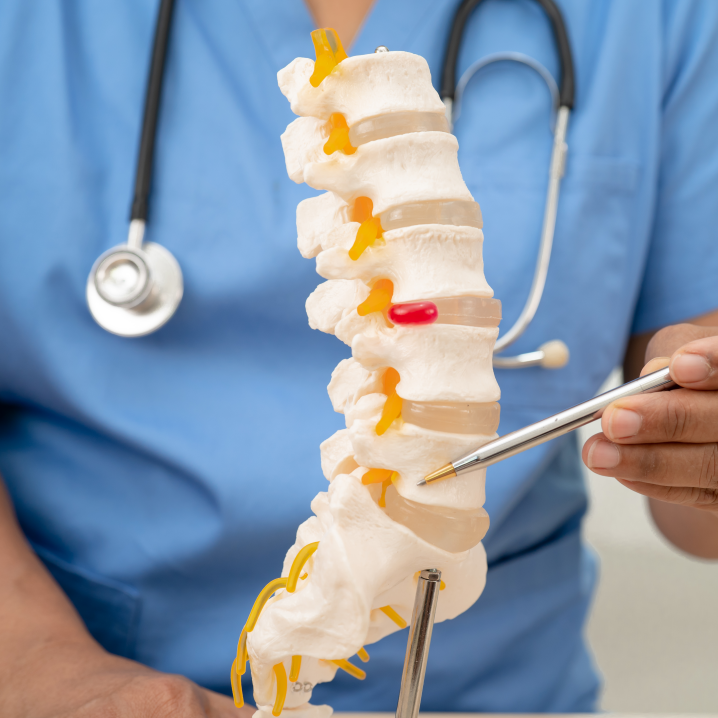 Spinal Fusion Surgery in Turkey