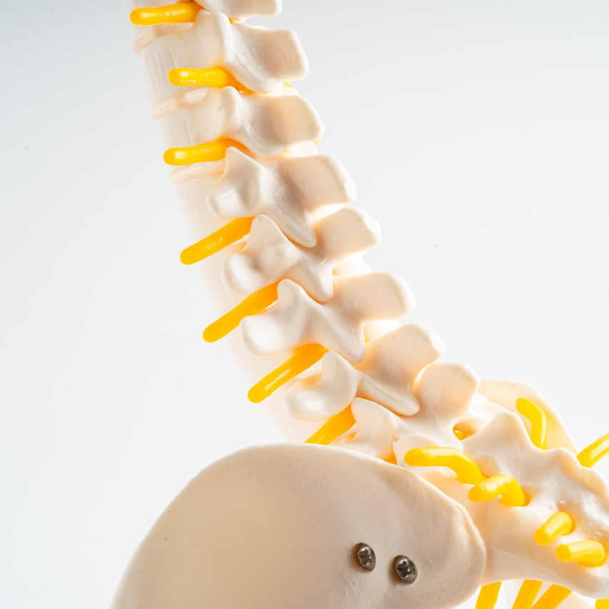 Vertebral Body Tethering VBT Surgery Treatment Antalya Turkey