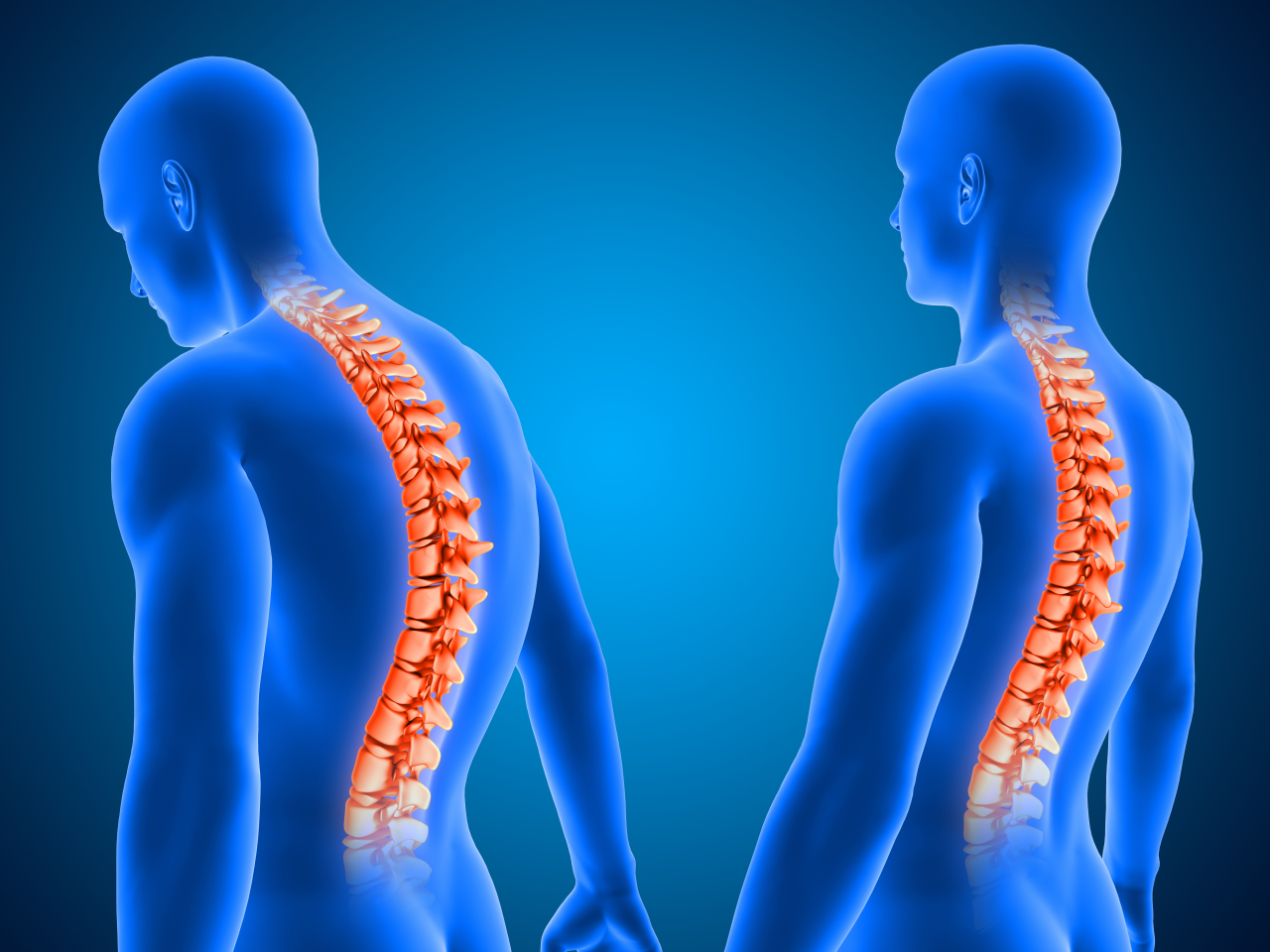 Vertebral Body Tethering VBT Surgery Treatment Antalya Turkey