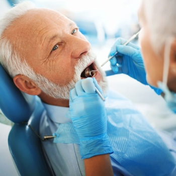 All-on-4 Dental Implants Pros and Cons