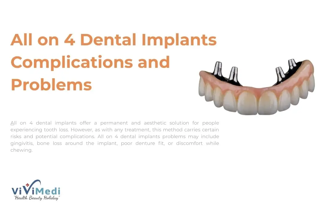 all-on-4-implants-complications-and-problems