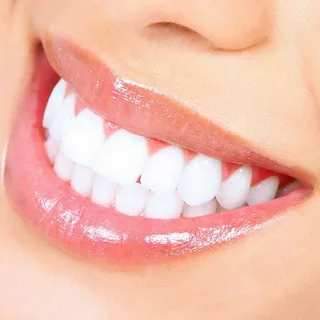 White Wonders: Transform Your Smile with Teeth Whitening Solutions