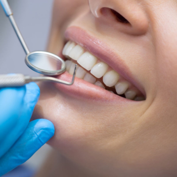 How to choose the best dental implant clinic in Turkey?