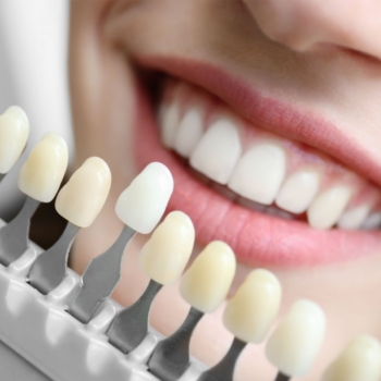 Advantages of Choosing Dental Clinic for Smile Makeover in Turkey