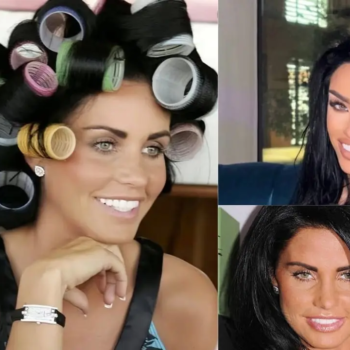 Katie Price Teeth