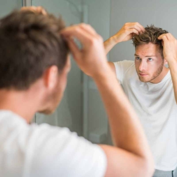 Post-Hair Transplant Care: How to Maintain Your New Hair