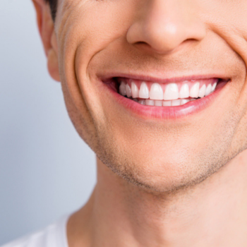 Why people prefer Turkey for smile makeover?