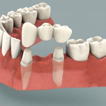 How long before tooth crown feels normal?