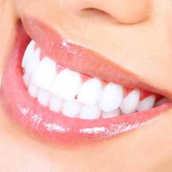 How much does teeth whitening cost in Turkey?