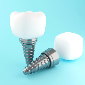 Implant-Supported Dentures: A Game-Changer in Restorative Dentistry