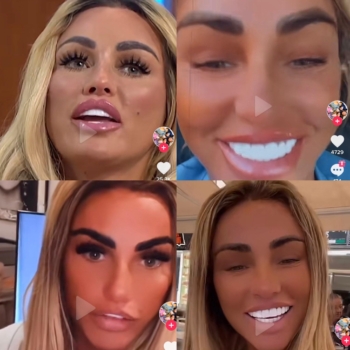 Katie Price Teeth