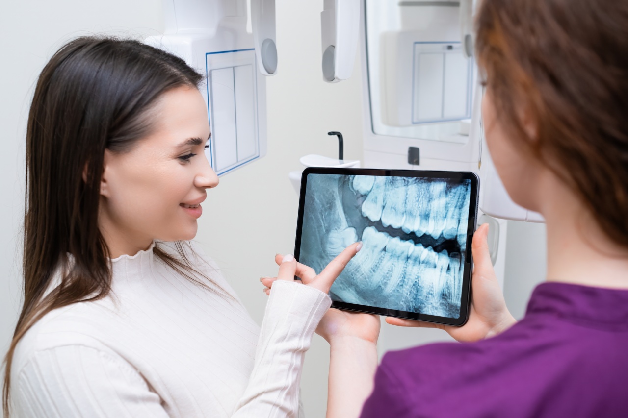 Hollywood Smile Dental Treatment in Turkey