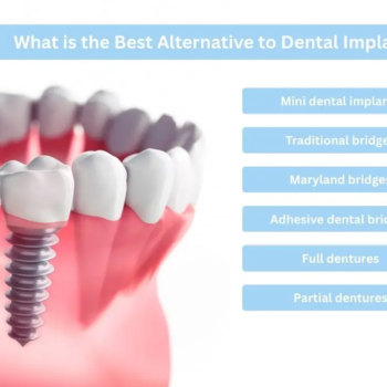 alternative-to-dental-implants
