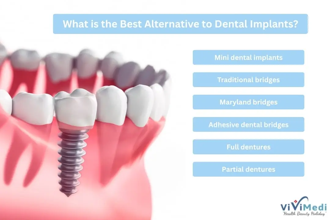 alternative-to-dental-implants