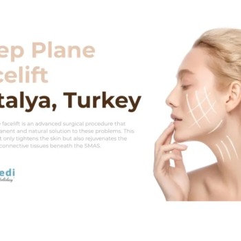 deep-plane-facelift-turkey-vivimedi