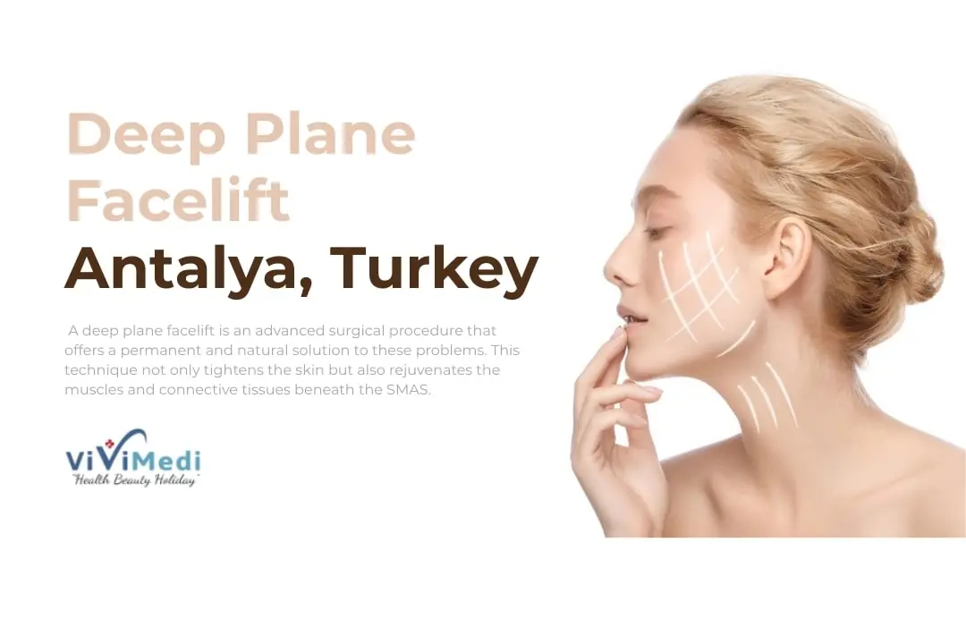 deep-plane-facelift-turkey-vivimedi
